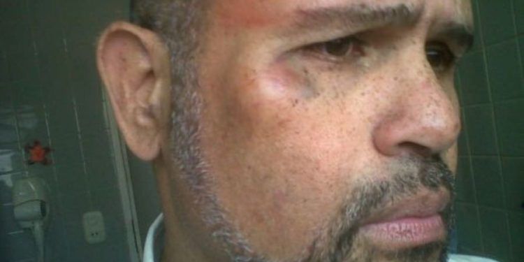GNB no defendió a periodistas ante amenazas en el CNE