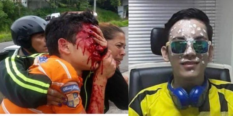 Táchira: Condenados funcionarios policiales que dejaron ciego al estudiante Rufo Chacón