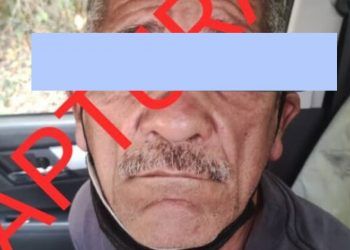 Miranda: Detenido hombre que le desfiguró el rostro a una mujer que ya no deseaba estar con el