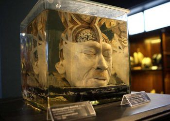 Chile: Museo de Anatomía celebra sus 100 años de vida