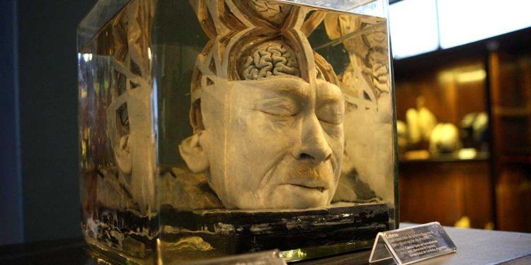 Chile: Museo de Anatomía celebra sus 100 años de vida