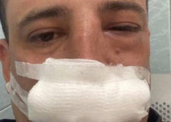 En Lara: Ataque violento deja a locutor inconsciente y lesionado en Estación Buenisima 103.9 FM