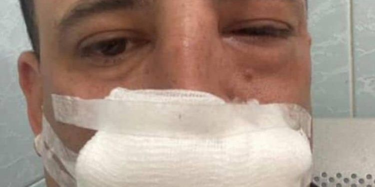 En Lara: Ataque violento deja a locutor inconsciente y lesionado en Estación Buenisima 103.9 FM