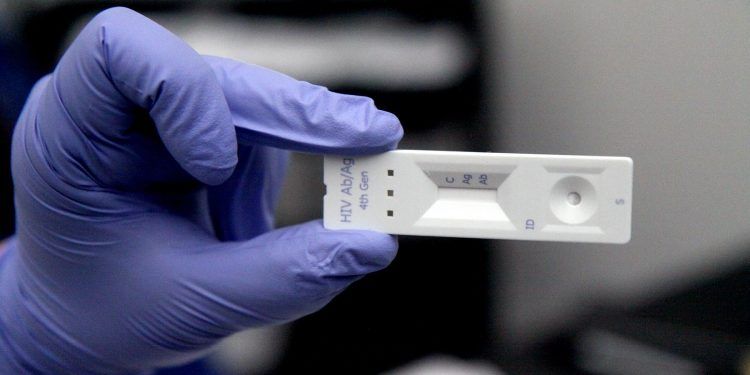 El doctor Afani destaca la importancia de aumentar el testeo para que "las personas tomen conciencia de la importancia de hacerse un chequeo periódico de VIH para conocer su estado serológico y, de esa manera, puedan ser puestas rápidamente en tratamiento".