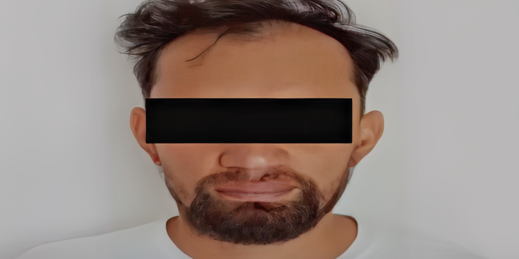 Detenido por el Cicpc tras vender fauna exótica en Facebook